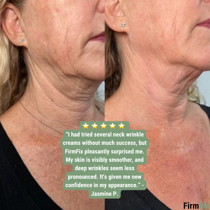 Firmix™ 2.0 : the new breakthrough for reducing the appearance of wrinkles on your neck