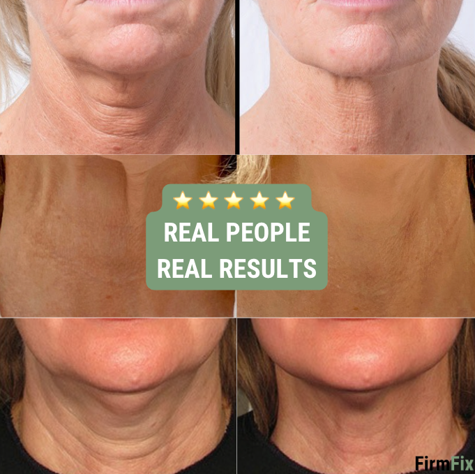 Firmix™ 2.0 : the new breakthrough for reducing the appearance of wrinkles on your neck